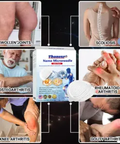 Thonesr® Nano-microneedle joint patch