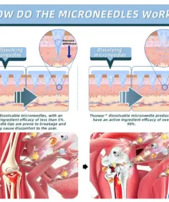Thonesr® Nano-microneedle joint patch