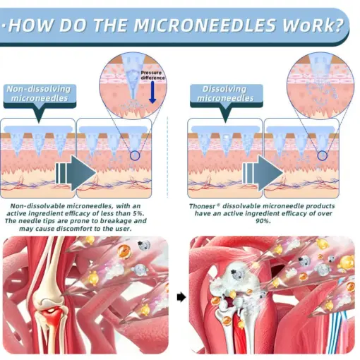 Thonesr® Nano-microneedle joint patch