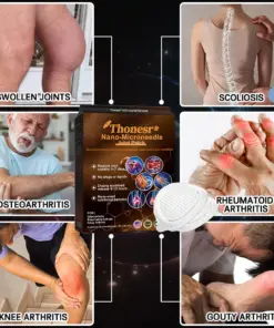 Thonesr® Nano microneedle joint patch