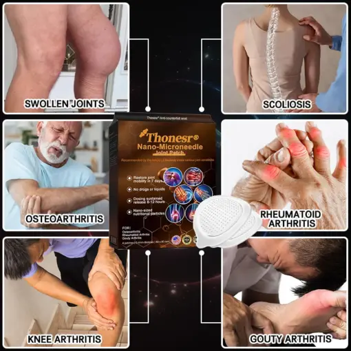 Thonesr® Nano microneedle joint patch