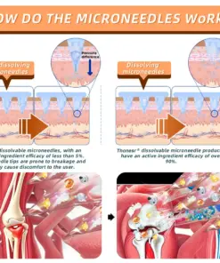 Thonesr® Nano microneedle joint patch