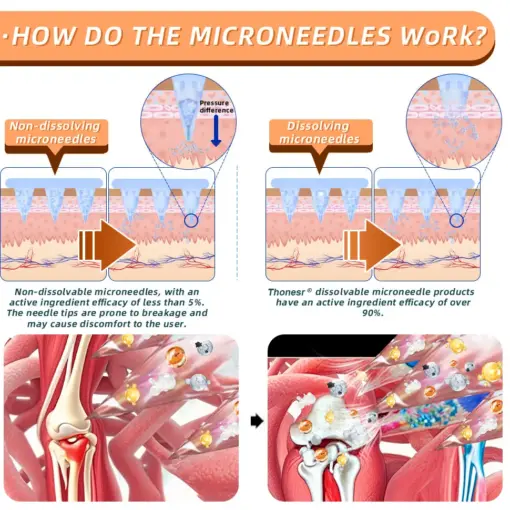 Thonesr® Nano microneedle joint patch