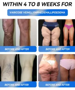 𝐓𝐡𝐨𝐧𝐞𝐬𝐫® 𝐆𝐋𝐏-𝟏 𝐏𝐫𝐨 𝐖𝐞𝐢𝐠𝐡𝐭 𝐋𝐨𝐬𝐬 𝐎𝐫𝐚𝐥 𝐒𝐨𝐥𝐮𝐭𝐢𝐨𝐧