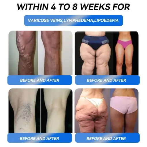 𝐓𝐡𝐨𝐧𝐞𝐬𝐫® 𝐆𝐋𝐏-𝟏 𝐏𝐫𝐨 𝐖𝐞𝐢𝐠𝐡𝐭 𝐋𝐨𝐬𝐬 𝐎𝐫𝐚𝐥 𝐒𝐨𝐥𝐮𝐭𝐢𝐨𝐧