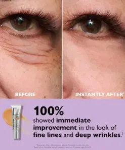 Perfection Eye Tightener - Thonesr® Instant Eye & Smooth Finish