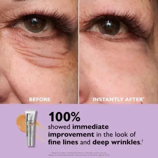 Perfection Eye Tightener - Thonesr® Instant Eye & Smooth Finish