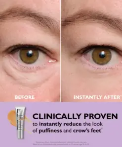 Perfection Eye Tightener - Thonesr® Instant Eye & Smooth Finish