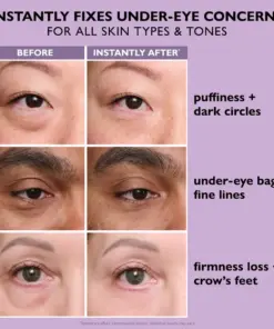 Perfection Eye Tightener - Thonesr® Instant Eye & Smooth Finish