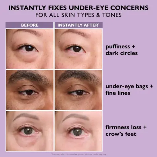 Perfection Eye Tightener - Thonesr® Instant Eye & Smooth Finish