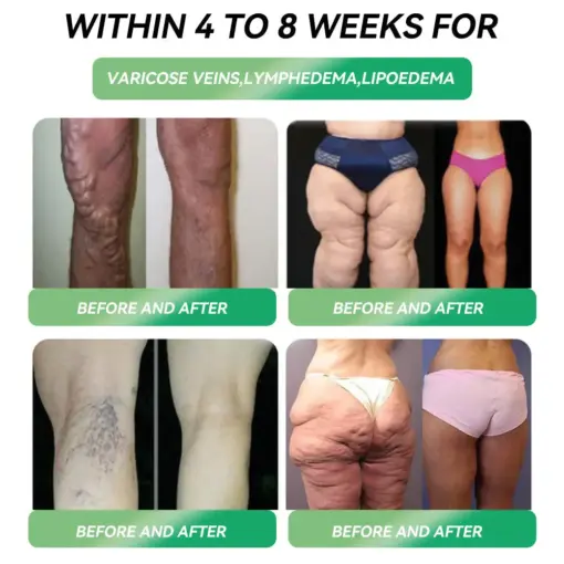 𝗧𝗵𝗼𝗻𝗲𝘀𝗿® 𝗚𝗟𝗣-𝟭 𝗦𝗹𝗶𝗺𝗺𝗶𝗻𝗴 & 𝗵𝗲𝗮𝗹𝘁𝗵 𝗢𝗿𝗮𝗹 𝗪𝗲𝗶𝗴𝗵𝘁 𝗟𝗼𝘀𝘀 𝗦𝗼𝗹𝘂𝘁𝗶𝗼𝗻𝘀