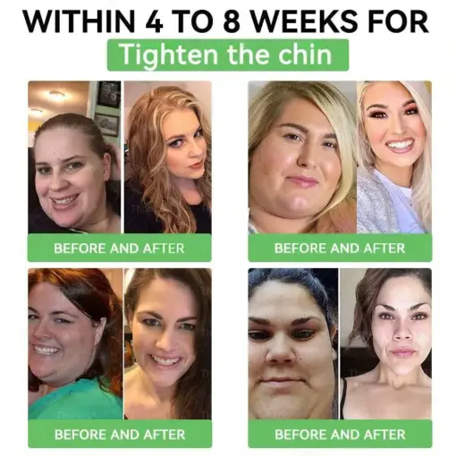 𝐓𝐡𝐨𝐧𝐞𝐬𝐫® & Tirzepatide 𝐆𝐋𝐏-𝟏 𝑷𝒓𝒐+ 𝑶𝒓𝒂𝒍 𝑾𝒆𝒊𝒈𝒉𝒕 𝑳𝒐𝒔𝒔 𝑺𝒐𝒍𝒖𝒕𝒊𝒐𝒏