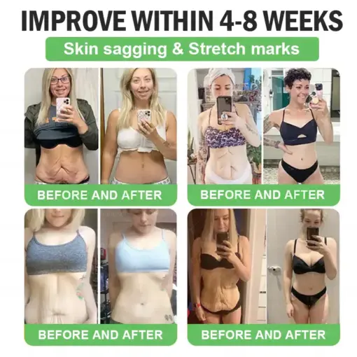 𝐓𝐡𝐨𝐧𝐞𝐬𝐫® & Tirzepatide 𝐆𝐋𝐏-𝟏 𝑷𝒓𝒐+ 𝑶𝒓𝒂𝒍 𝑾𝒆𝒊𝒈𝒉𝒕 𝑳𝒐𝒔𝒔 𝑺𝒐𝒍𝒖𝒕𝒊𝒐𝒏