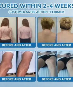 Thonesr® BPC-157 Joint Healing Cream