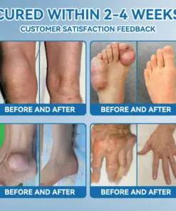 Thonesr® BPC-157 Joint Healing Cream
