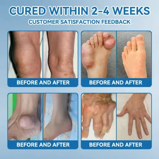 Thonesr® BPC-157 Joint Healing Cream