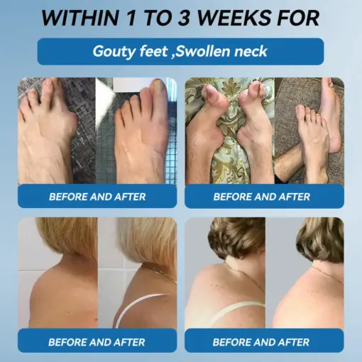 Thonesr® BPC-157 Joint Healing Cream