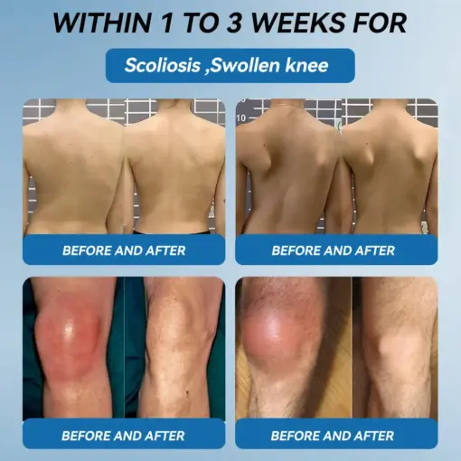 Thonesr® BPC-157 Joint Healing Cream