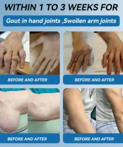 Thonesr® BPC-157 Joint Healing Cream