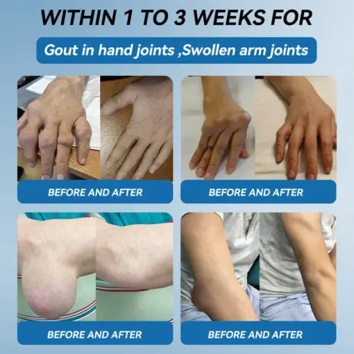 Thonesr® BPC-157 Joint Healing Cream