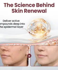 Thonesr® KeraErase Dual-Action Renewal Cream