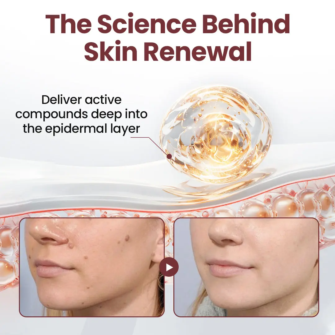 Thonesr® KeraErase Dual-Action Renewal Cream