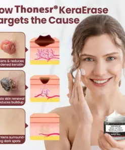 Thonesr® KeraStase Dual-Action Renewal Cream