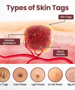 Thonesr® KeraStase Dual-Action Renewal Cream